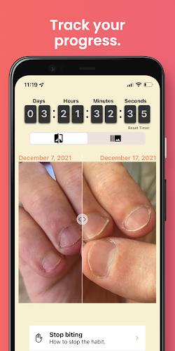 NailKeeper - Stop Biting Nails Screenshot3