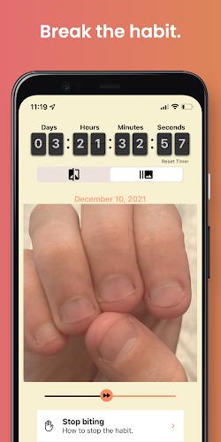 NailKeeper - Stop Biting Nails Screenshot2