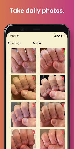 NailKeeper - Stop Biting Nails Screenshot1