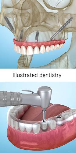 Dental 3D Illustrations Screenshot6