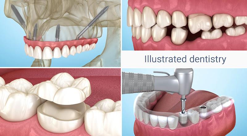 Dental 3D Illustrations Screenshot19