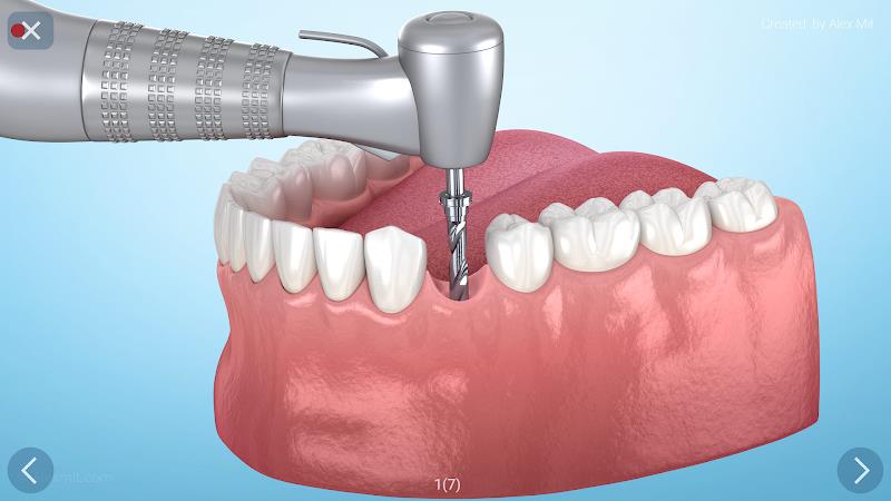 Dental 3D Illustrations Screenshot24