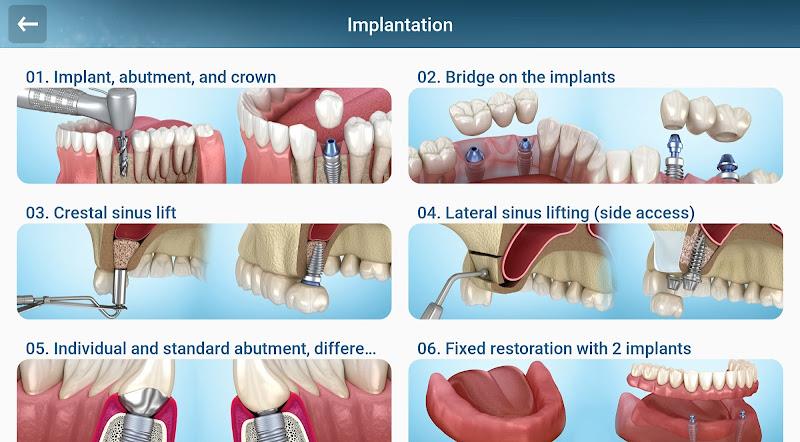 Dental 3D Illustrations Screenshot17