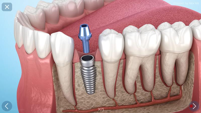 Dental 3D Illustrations Screenshot25