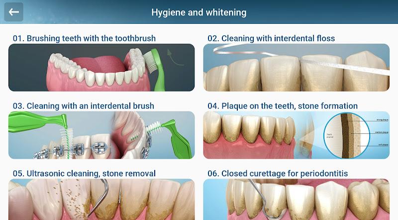 Dental 3D Illustrations Screenshot10