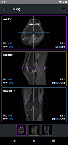 IDV - IMAIOS DICOM Viewer Screenshot4