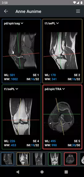 IDV - IMAIOS DICOM Viewer Screenshot3