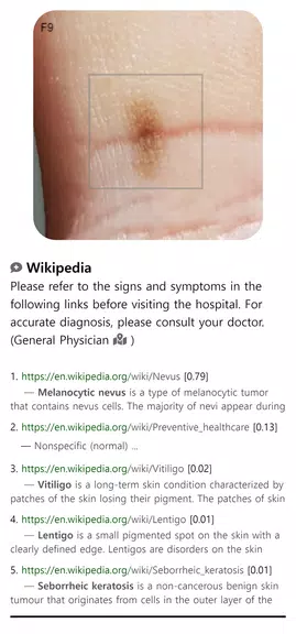 Model Dermatol – Skin Disease Screenshot4