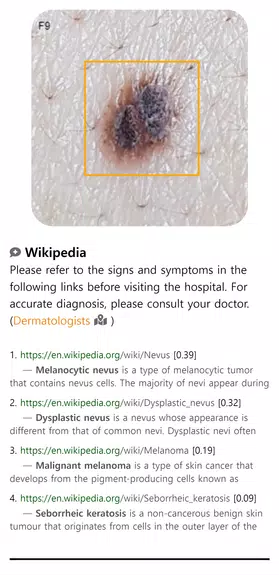 Model Dermatol – Skin Disease Screenshot3