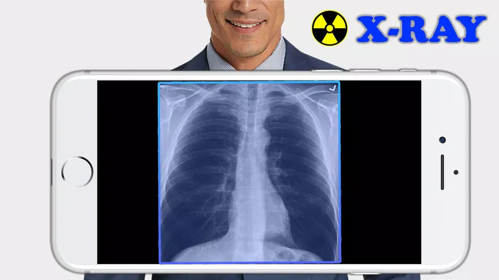 X-Ray Filter Photo Screenshot1